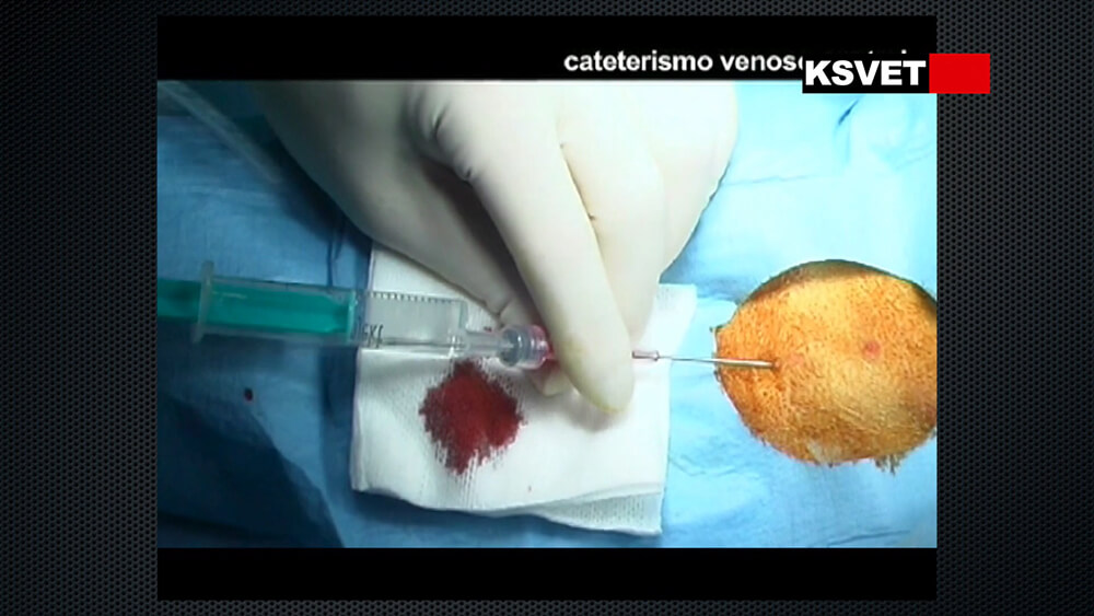 Cateterismo venoso central