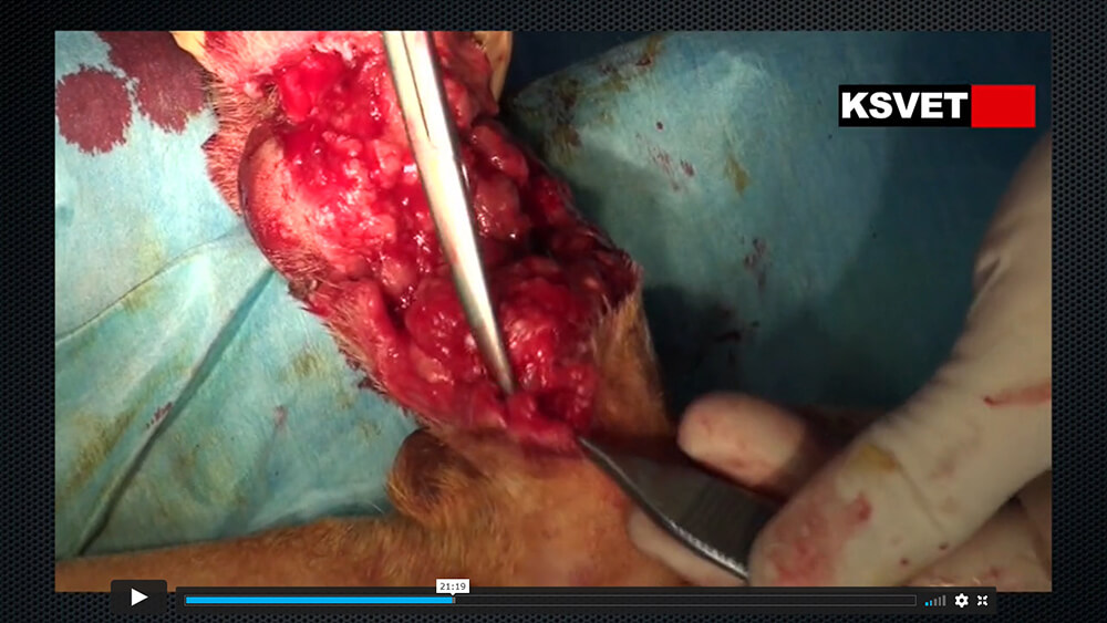 Reconstrucción quirúrgica y estabilización de fractura producidas por arma de fuego en área de la mano